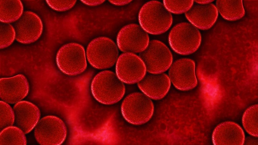 Chronická myelocytová leukémia (CML) Chronická myelocytová leukémia (CML)