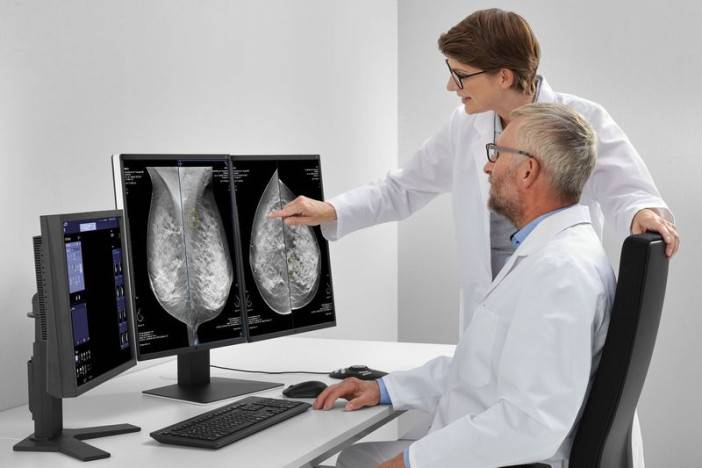 Lepšia diagnostika rakoviny prsníka vďaka umelej inteligencii