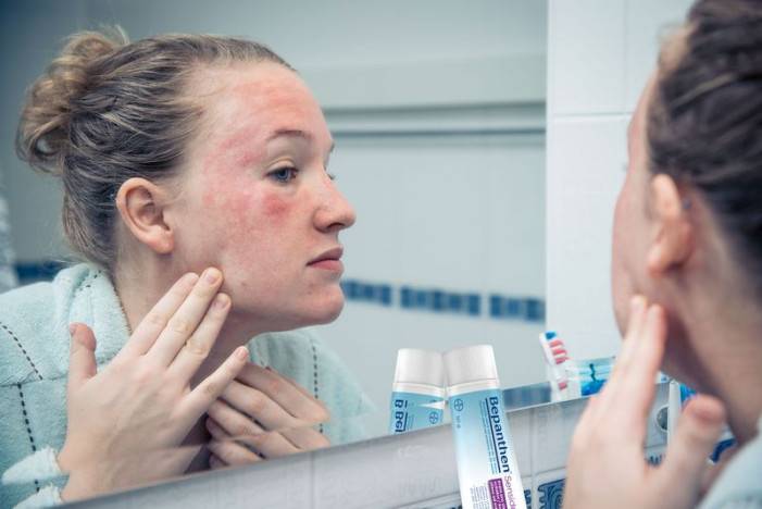 Jesenná skin care rutina pre každého – stop popraskanej a vysušenej pokožke