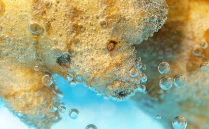 Baktéria Legionella vo vode  - riziká, výskyt a prevencia