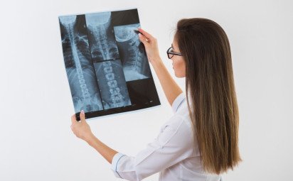 Osteoporóza a zásady, ktoré treba dodržiavať