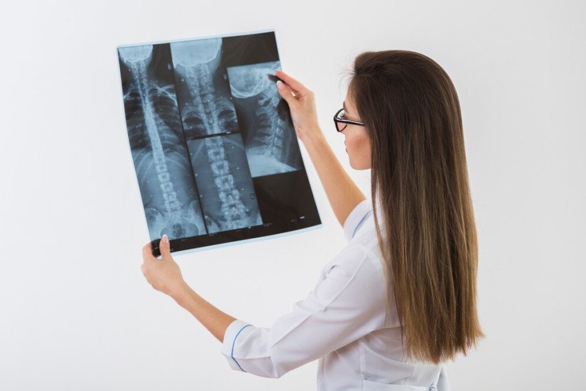 Osteoporóza a zásady, ktoré treba dodržiavať