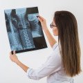 Osteoporóza a zásady, ktoré treba dodržiavať