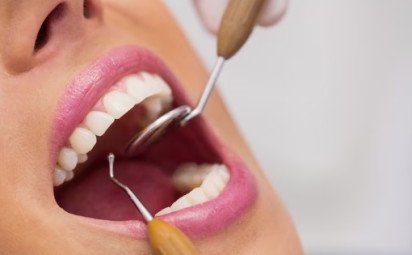Dentálna hygiena by mala mať pravidelný termín vo vašom diári