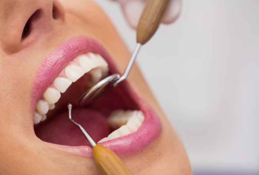 Dentálna hygiena by mala mať pravidelný termín vo vašom diári