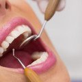 Dentálna hygiena by mala mať pravidelný termín vo vašom diári