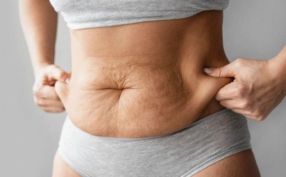 Strie sú častý problém. Môžeme im však predchádzať?