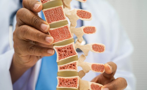 Až polovica pacientov do roka preruší svoju liečbu osteoporózy