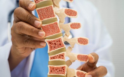 Až polovica pacientov do roka preruší svoju liečbu osteoporózy