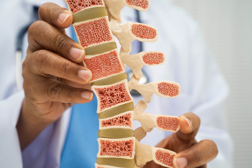 Až polovica pacientov do roka preruší svoju liečbu osteoporózy