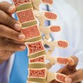 Až polovica pacientov do roka preruší svoju liečbu osteoporózy